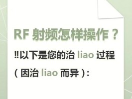 rf射频的原理和作用